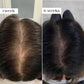 ThickBloom™ Hair Growth